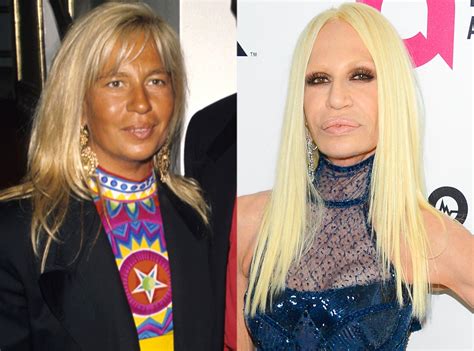 current photo donatella versace|donatella versace before and after.